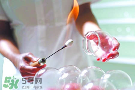 冬天拔罐后多久能洗澡？警惕冬季拔罐后不宜立即洗澡