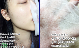 稚優(yōu)泉面膜怎么用？稚優(yōu)泉面膜要洗嗎？