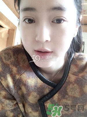 什么是定點雙眼皮？定點雙眼皮多少錢？