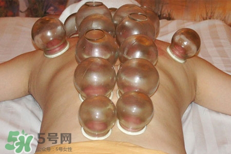 冬天可以拔罐放血嗎？冬天拔罐放血好嗎？
