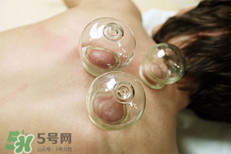 春天拔罐好嗎？春季最好的養生方法