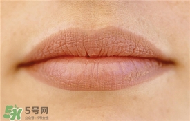 卡唇紋是什么意思？卡唇紋怎么辦？