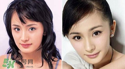 打瘦臉針能懷孕嗎？打瘦臉針能吃避孕藥嗎？