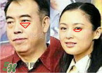 臥蠶是黑眼圈嗎？臥蠶和黑眼圈的區別