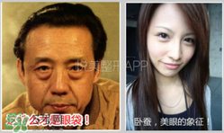 臥蠶是黑眼圈嗎？臥蠶和黑眼圈的區別