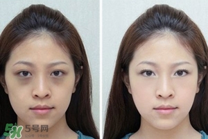 臥蠶是黑眼圈嗎？臥蠶和黑眼圈的區別
