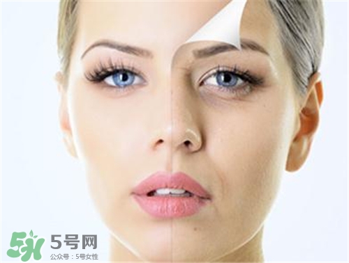 玻尿酸除皺有效果嗎？玻尿酸除皺效果怎么樣？