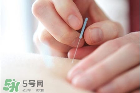 沒病可以針灸嗎？沒病可以扎針嗎？