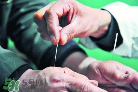 沒病可以針灸嗎？沒病可以扎針嗎？