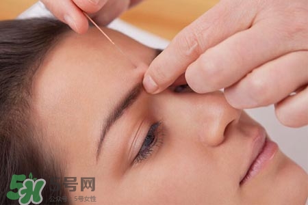 沒病可以針灸嗎？沒病可以扎針嗎？