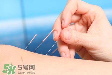 沒病可以針灸嗎？沒病可以扎針嗎？
