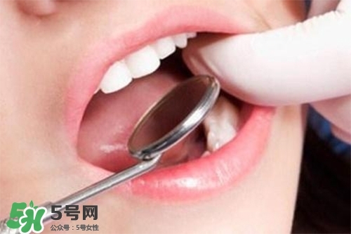 口腔異味是怎么回事？口腔異味怎么清除？