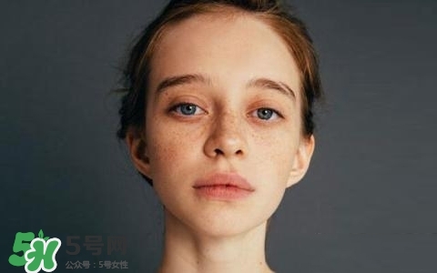 長(zhǎng)斑是什么原因引起的？祛斑效果最好的方法