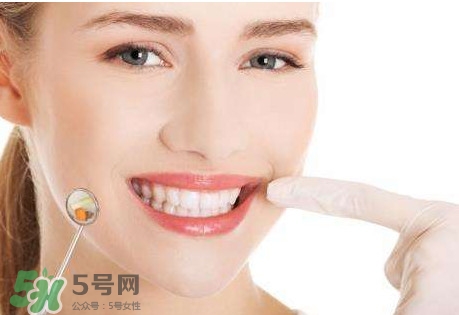 牙結石是什么？牙結石圖片