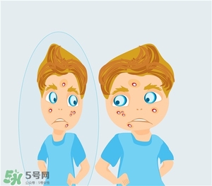 得了痤瘡飲食注意什么？有痤瘡吃東西注意什么