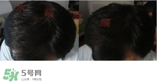  資生堂不老林洗發水怎么樣？資生堂不老林洗發水能長頭發嗎