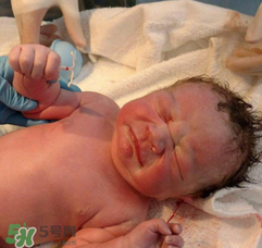 新生兒手握避孕環(huán)出生是怎么回事？出生后健康嗎？