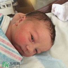 新生兒手握避孕環(huán)出生是怎么回事？出生后健康嗎？