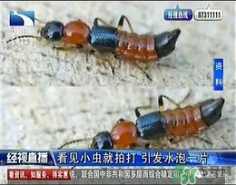 隱翅蟲有毒嗎？隱翅蟲會毀容嗎？