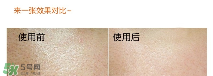 城野醫生毛孔收斂水真的有用嗎