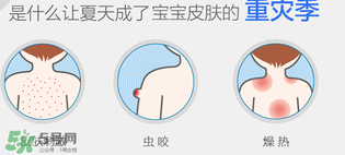 妙思樂爽膚水好用嗎？妙思樂爽膚水能去痱嗎？