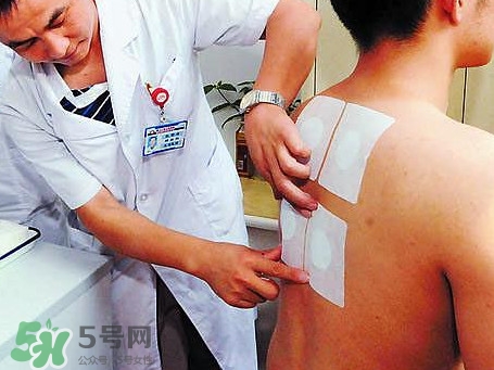 三伏灸可以治療什么病？三伏灸與艾灸有什么區(qū)別