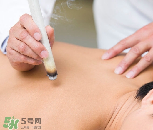 三伏貼和艾灸哪個好？三伏貼和艾灸區別