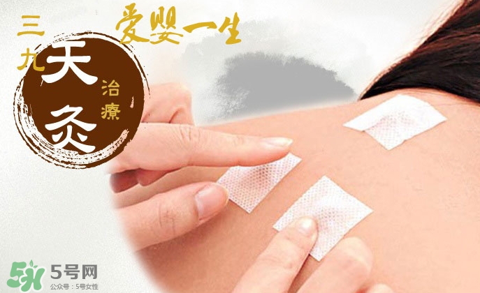 貼三伏貼掛什么科？三伏貼掛什么號？