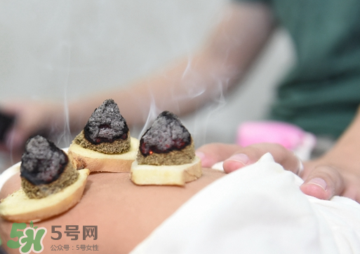 三伏灸什么人不能做？三伏灸適合哪些人？