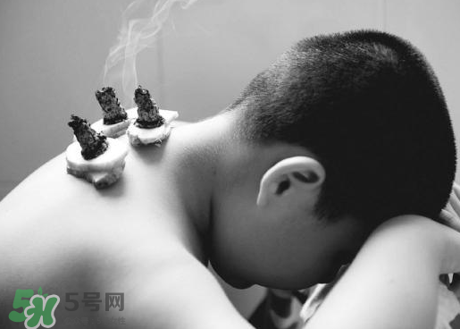 三伏灸什么人不能做？三伏灸適合哪些人？