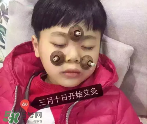 艾灸貼可以治咳嗽嗎？艾灸貼可以治退燒嗎？