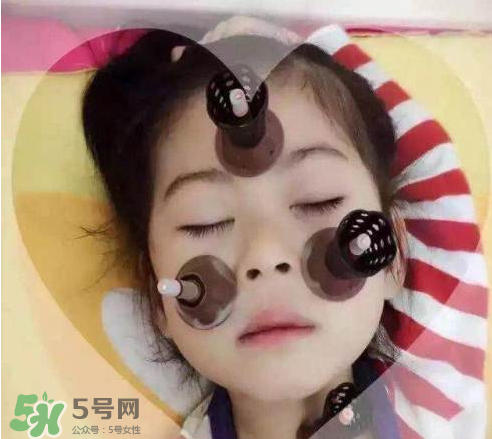 艾灸貼可以治咳嗽嗎？艾灸貼可以治退燒嗎？