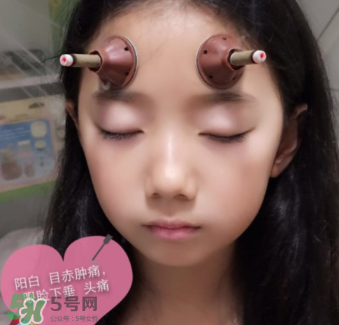 艾灸貼可以治咳嗽嗎？艾灸貼可以治退燒嗎？
