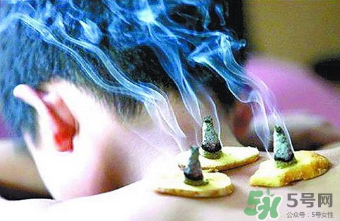 三伏灸什么時候開始灸？三伏灸怎么灸？