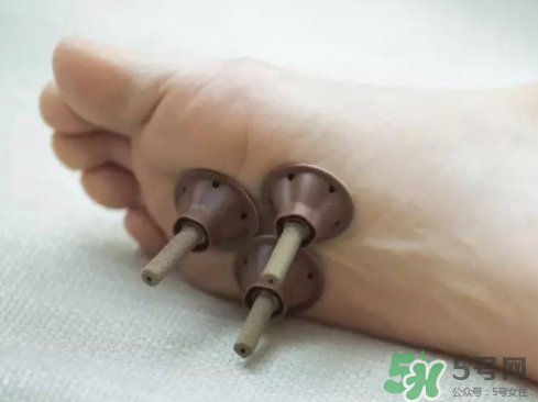 艾艾貼灸出水珠為什么？艾艾貼后有水珠要擦嗎？