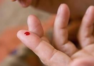 放血療法能治濕氣重嗎？放血療法治病的原理是什么