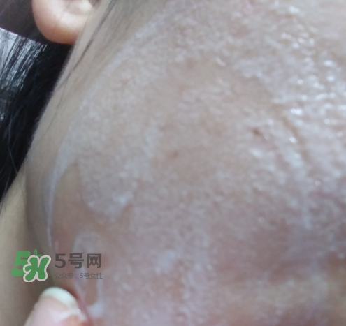 貝蜜清凈痘控油潔面啫喱怎么樣？貝蜜清祛痘控油潔面啫喱好用嗎？