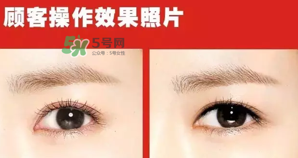美瞳線有必要做嗎？做美瞳線多少錢？