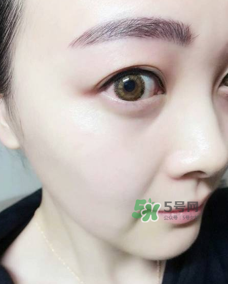 做美瞳線對眼睛有傷害嗎？做美瞳線會傷眼睛嗎？