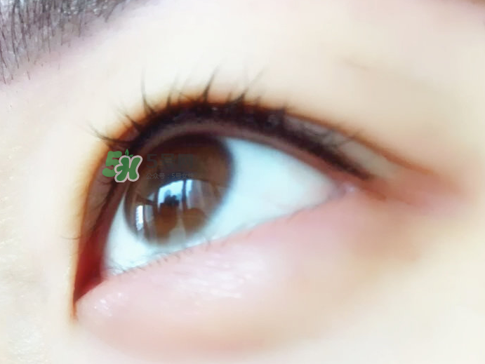 做美瞳線麻藥進(jìn)眼睛怎么辦？做美瞳線麻藥灼傷眼睛怎么辦？