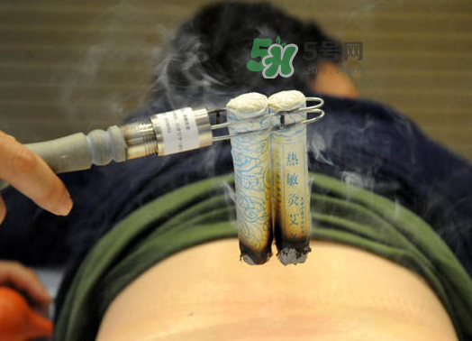 三伏天艾灸后能吹空調嗎？三伏天艾灸后能吹電扇嗎？