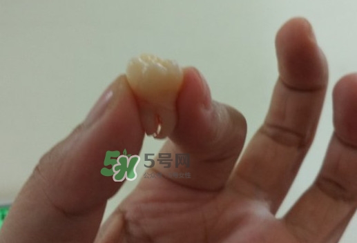 拔智齒痛嗎？智齒拔了多久洞會(huì)好？