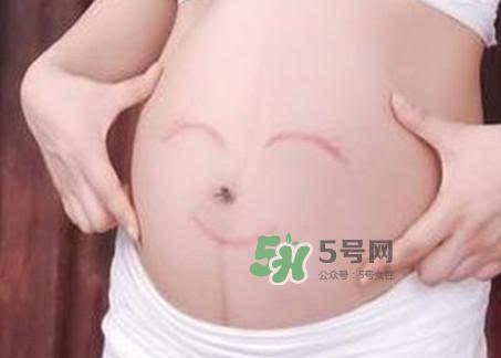 產婦胃脹氣怎么緩解？產婦胃脹氣怎么辦？