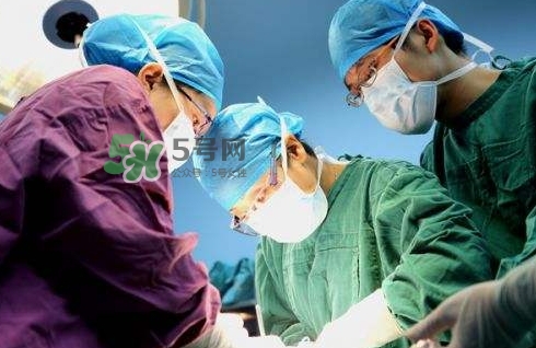 剖腹產下面會松弛嗎？剖腹產有什么后遺癥嗎？