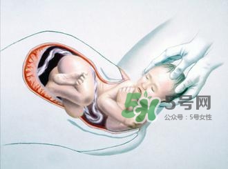 順產和剖腹產哪個好？順產和剖腹產哪個痛？