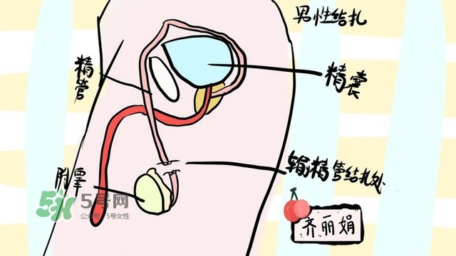 生完二胎一定要結扎嗎？生完二胎結扎好不好？