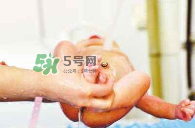 羊水栓塞是醫(yī)療事故嗎？羊水栓塞多發(fā)生于順產(chǎn)還是剖腹產(chǎn)？