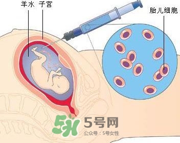 羊水栓塞是怎么回事？羊水栓塞怎么預防？