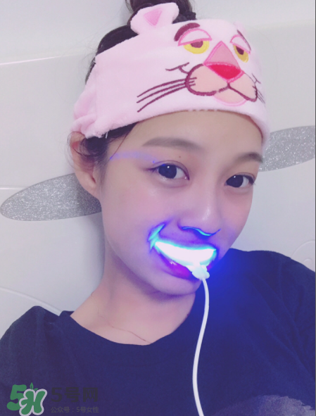 美牙儀能去牙結石嗎？美牙儀對牙結石有效嗎？