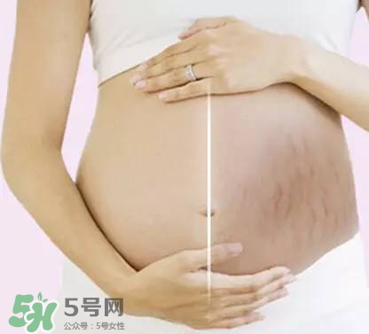 長妊娠紋的前兆 長妊娠紋很癢怎么辦？